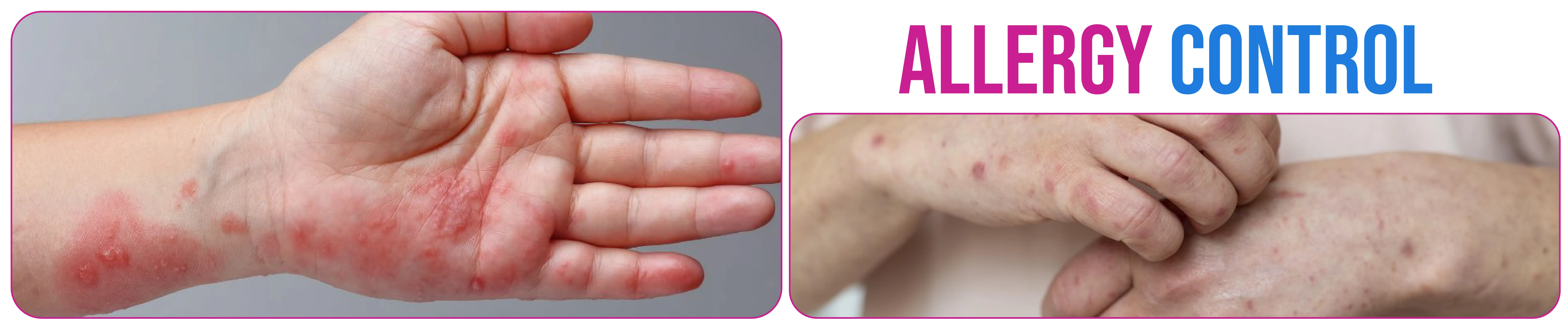 carpet cleaning in brooklyn, carpet cleaning in brooklyn, carpet cleaning brooklyn, carpet cleaners in brooklyn, carpet cleaners in brooklyn, commercial carpet cleaning, commercial carpet cleaning in brooklyn, brooklyn rug cleaners, rug cleaning services in brooklyn, same day carpet cleaning, same day rug cleaning